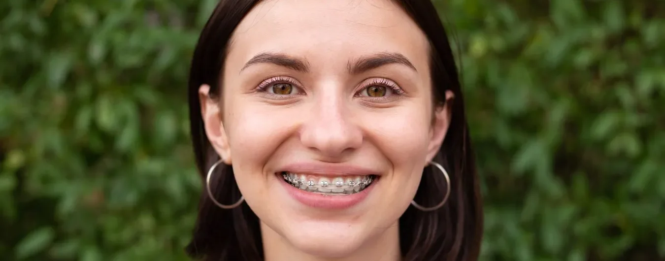 same day braces